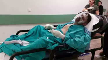 Tinerle Yanarak Ağır Yaralandı