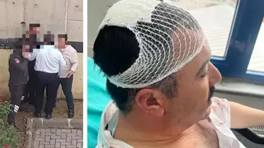 Yeniden Refah Partili başkan yardımcıları arasında kavga: Kafasını şekerlikle parçaladı
