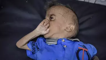 İsrail Ablukası Altındaki Filistinli Bebek Açlıkla Mücadele Ediyor