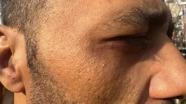 Taksim'de 'Borcunu sileceğiz' yalanıyla alıkonulup darbedildi: 'Şikayetini çek aileni öldürürüz' tehdidi