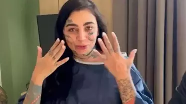İddia vahim: Mozambikli sosyal medya fenomeni Türkiye'de estetik ameliyatı sonrası öldü