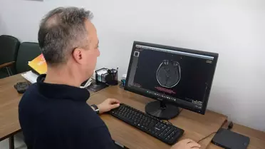 Yapay Zeka ile Nörolojik Teşhis Devrimi