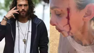 Can Yaman'ın sevgilisi Sara Bluma şiddet gördüğünü açıkladı