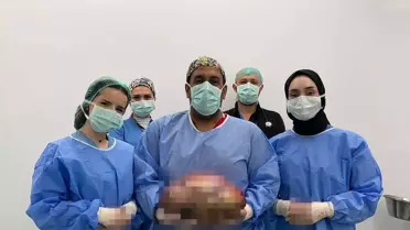 Şişlik yüzünden gitti, karnından çıkan doktorları bile şoke etti