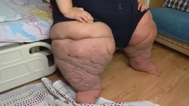 Sadece iki yılda bu hale geldi! Evden bile çıkamıyor
