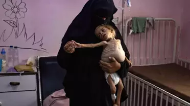 Gazze'de Açlık: Son 24 Saatte 4 Sivil Hayatını Kaybetti