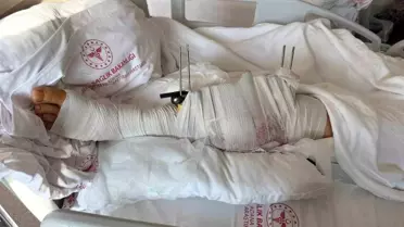 Muhtar, Eski Damadını Vurarak Yaraladı