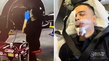 Otomobil tamirinde korkutan kaza! İşçinin gözüne tornavida saplandı