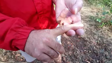 Ayı saldırısında parmağını kaybetti! Dehşet anlarını bu sözlerle anlattı