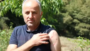 Mudurnu'da Ayı Saldırısı: 1 Yaralı