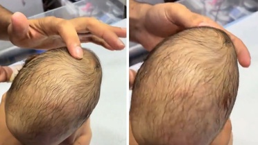 Yeni doğan bebeğin bıngıldağına basan doktorun gördüğü manzara korkunç