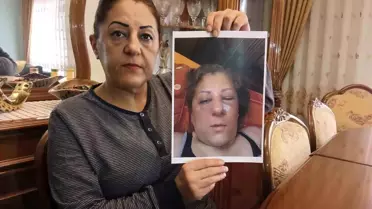 Ankara'da Komşu Kavgası: Kadın Darbedildi