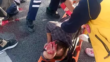 Motosiklet Sürücüsü Sokak Köpeğine Çarpmamak İçin Bariyere Çarptı