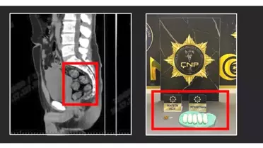 Tomografideki görüntü şoke etti! Zehir tacirleri yakayı böyle ele verdi
