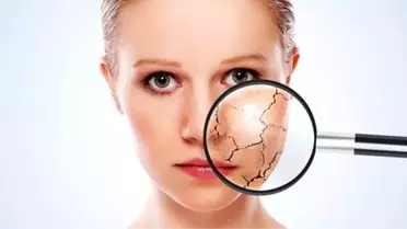 Kış Cilt Bakımı: Mezoterapi ile Yenileyin