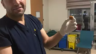 Zihinsel Engelli Kadının Yeme Borusundaki Ceviz Çıkarıldı