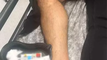 Marmaris'te Silahlı Kavga: 1 Yaralı