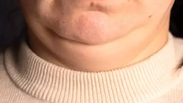 Boyun Kalınlığı Sağlığınızı Gösteriyor