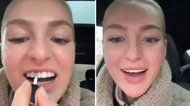 Dişlerini beyazlatmak için yaptığı akılalmaz!