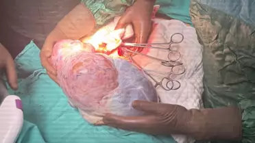 Ordu'da 5 Kilogramlık Kitle Başarıyla Alındı