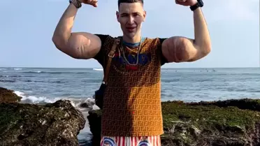 Rus Temel Reis'in kolları tehlikede: Tehlikeli enjeksiyonlar ağır enfeksiyona yol açtı