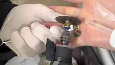 Batman'da Parmağa Sıkışan Yüzükler Kurtarıldı