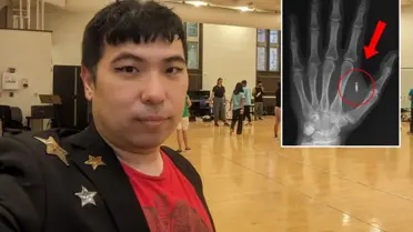 Akılalmaz hata! Eline yerleşltirdiği mikroçipin şifresini unuttu