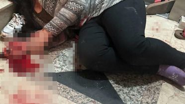 Boşanma Aşamasındaki Eşini Yaralayan Adem T.'nin Cezası Onandı