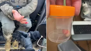 ICE karşıtı protestolarda şoke eden olay: Görevlinin parmağını ısırarak kopardılar