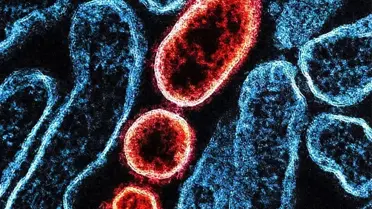 Hindistan'da Nipah Virüsü Salgını