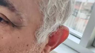 Müezzinin, sıra yüzünden aile hekimini darbettiği iddiası