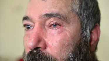 Dolmuş Şoförünün Gözünü Kaybetmesi