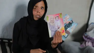 İsrail saldırısında yüzünün bir kısmını kaybeden Gazzeli annenin tek dileği çocuklarının korkmadan ona sarılması