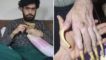 Türkiye'nin konuştuğu Barış'ın yeni işini ve son halini görenler şaşıp kalıyor