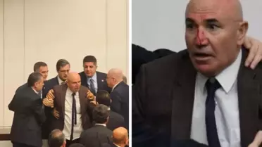 Meclis'teki kavgada Mahmut Tanal'ın burnu kanadı