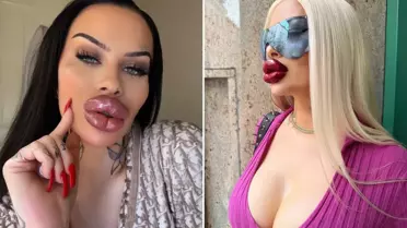 Estetiğe 60 bin dolar harcayan fenomen: Artık ağzımı kapatamıyorum