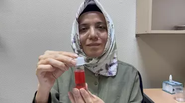 SDÜ Göz Bankası: 100'den Fazla Kornea Nakli