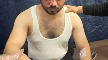 Suriye'de Patlama: Üç Yaralı