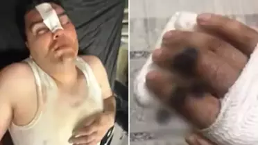 Hesabı ortak ödediler, dayağı tek başına yedi! Her şey 13 binlik 'çerez' ile başladı