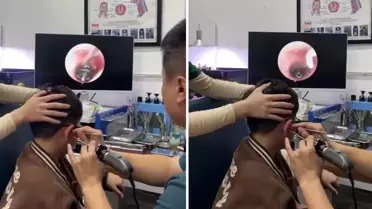 Küçük çocuğun kulağından çıkana, doktorlar bile şaştı kaldı