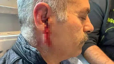 Silivri'de İşten Çıkan İşçiye Darbe