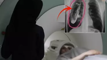 Hastaya ''Göğsünde canlı böcek var'' dendi, gerçek çok başka çıktı