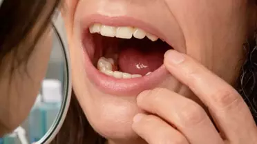 Sabah uyandığında dişleri yoktu! Doktorları bile şaşırtan gerçek hastaneye ortaya çıktı