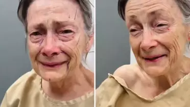 Estetik operasyonu sonrası geçirdiği değişim inanılmaz