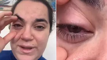 Bulaşık makinesi tableti kadının gözüne patladı, kör olma korkusu yaşadı