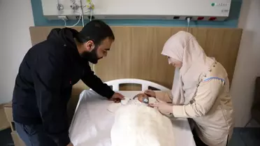 Talha Bebeğin Nadir Tümörü Başarıyla Alındı