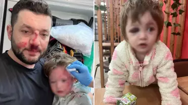 İşte 14 aylık İkra bebeği hastanelik edenlere istenen ceza! Skuter silah sayıldı