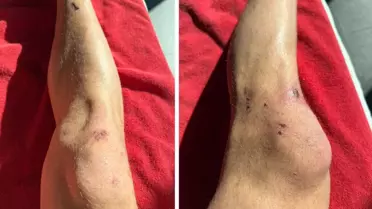 Dün gece yaşanan tarihi zaferin bedeli