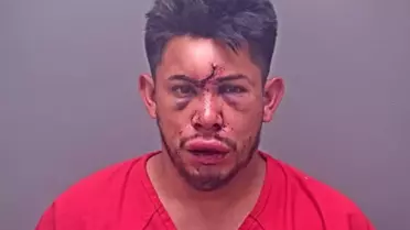 13 yaşındaki çocuk, evdeki olayı görünce babasını bu hale getirdi