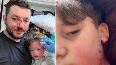 Yalova'da husumet büyüyor: Aynı ailenin 8 yaşındaki çocuğu da yaralandı